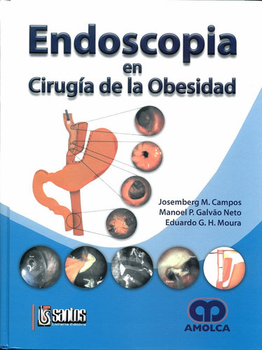 Endoscopia En Cirugía De La Obesidad - Campos - Usado