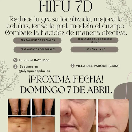 Hifu 7d Corporal Y Facial