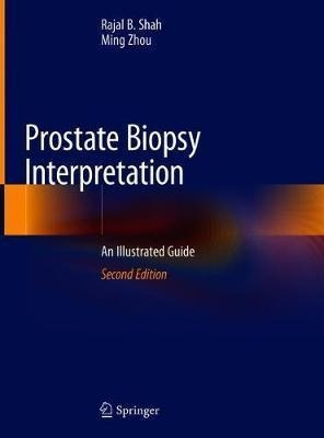 prostate biopsy interpretation an illustrated guide