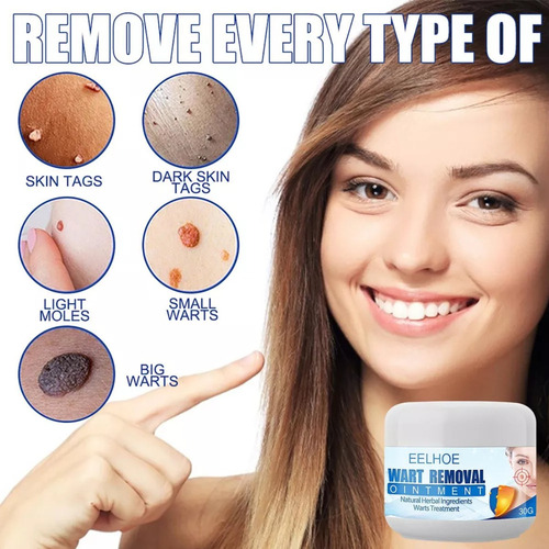 2× Crema Del Retiro La Verruga Y Del Topo Del Removedor