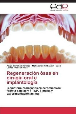Regeneracion Osea En Cirugia Oral E Implantologia - Prado...