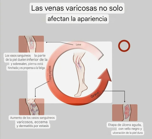 Medias De Compresión L Xl