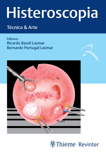 Histeroscopia: Técnica & Arte, de Lasmar, Ricardo Bassil. Editora Thieme Revinter Publicações Ltda, capa dura em português, 2020
