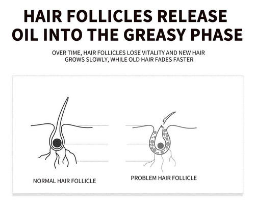 Shampoo De Extrato De Ginseng Para Anti-queda De Cabelo Sham