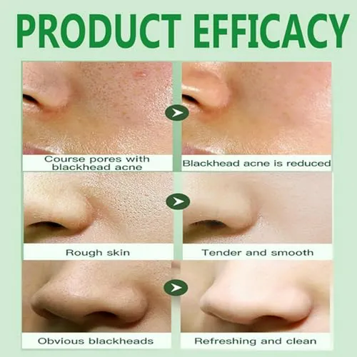 Mascarilla Facial De Burbujas Con Centella Asiática (4 Unida
