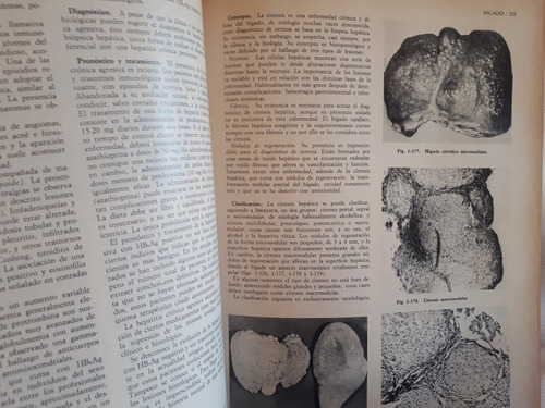 Imagen 9 de 9 de Medicina Interna 2 Tomos Rozman & Farreras Marin Tapa Dura