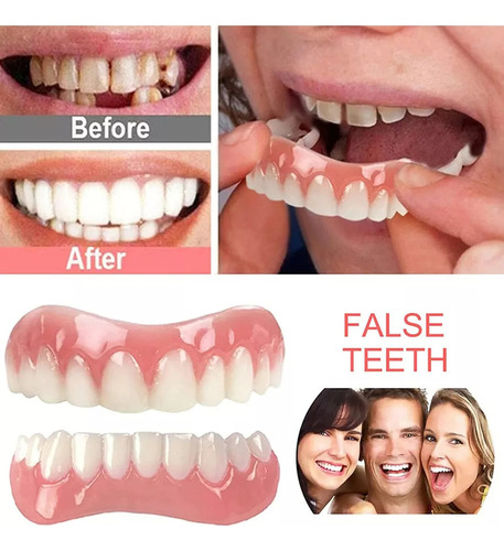 Carillas De Silicona Superiores E Inferiores Para Dientes De
