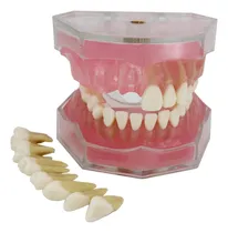 Comprar Modelo De Estudio De Implantes Dentales Con Dientes Removibl
