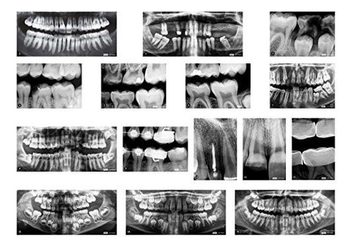 Roylco R-59269 Dental Rayos X, Juego De 17
