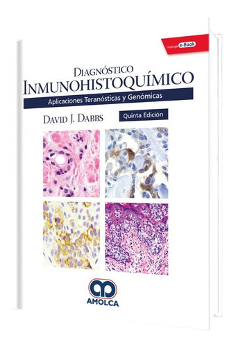 Diagnóstico Inmunohistoquímico Teranósticas Y Genómicas Dabb