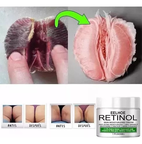 Crema Blanqueadora Aclaradora Partes Intimas, Ojeras Manchas