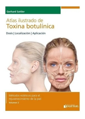 Atlas Ilustrado De Toxina Botulínica Nuevo!