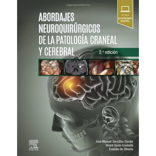 Abordajes Neuroquirurg. De La Patologia Craneal Y Cerebral 2