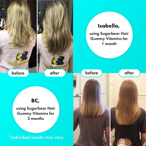 Vitaminas Para El Cabello Sugarbear Para Una Buena Causa (15