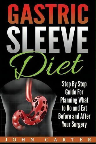 Gastric Sleeve Diet : Step By Step Guide For Planning What To Do And Eat Before And After Your Su..., De John Carter. Editorial Guy Saloniki, Tapa Blanda En Inglés