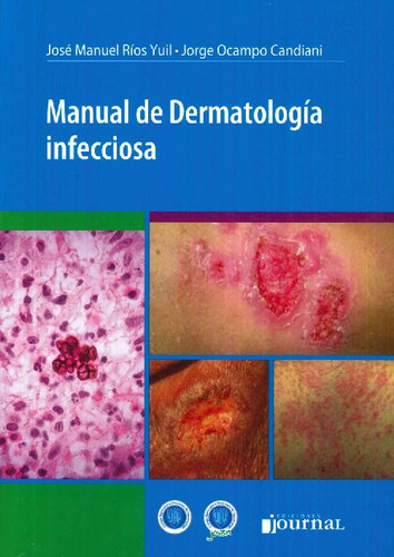 Libro Manual De Dermatología Infecciosa De José Manuel Ríos