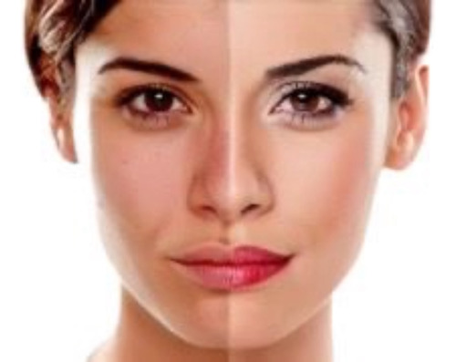 Suavicyd Creme Clareador Avançado P/ Melasma Manchas Estrias Todo Tipo De Pele Noite