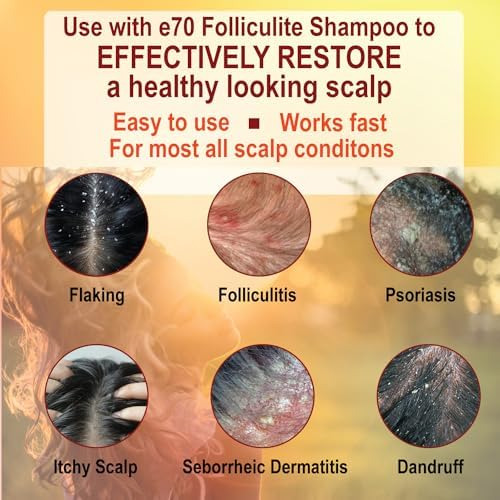 Conjunto Shampoo E Condicionador, Shampoo Salicílico Para Fo