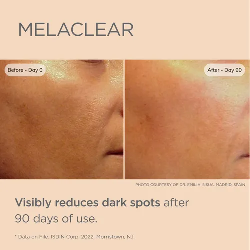 Sérum Corrector De Manchas Oscuras Isdin Melaclear Con Vitam