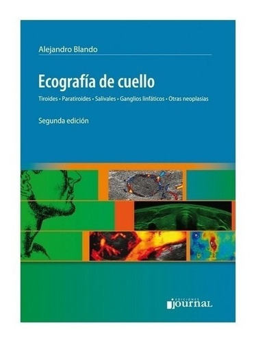 Ecografia De Cuello Tiroide-paratiroide-salivale-glanglio L.