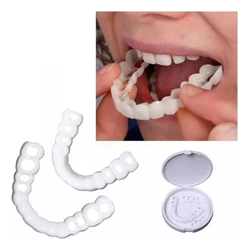[ Tampa De Dente Falso Superior Encaixe Sem Sorriso
