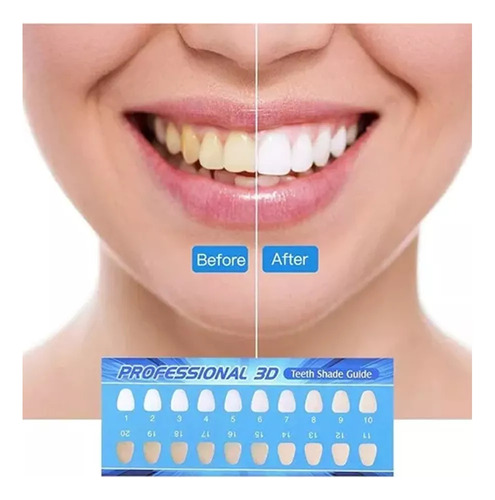 V Aparelho De Branqueamento De Dentes Gel De Dentes