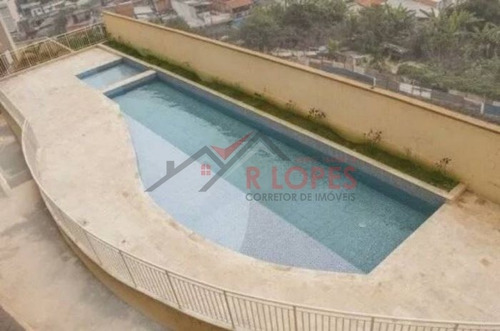 Imagem 13 de 14 de Lindo Apartamento Para Venda No Bairro Itaquera, 2 Dorm, 1 Vagas, 49 M - 1129