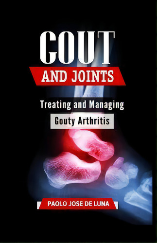 Gout And Joints : Treating And Managing Gouty Arthritis, De Paolo Jose De Luna. Editorial Createspace Independent Publishing Platform, Tapa Blanda En Inglés