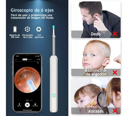 Limpiador Oídos Cámara Quita Cerilla Inteligente Endoscopio