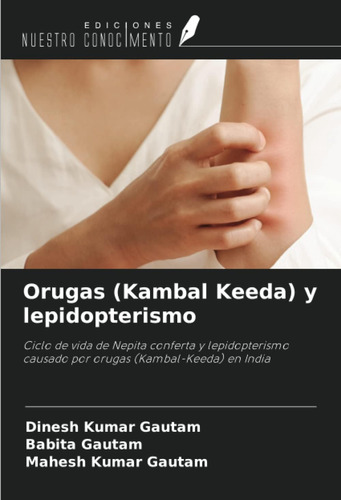 Libro: Orugas (kambal Keeda) Y Lepidopterismo: Ciclo De Vida