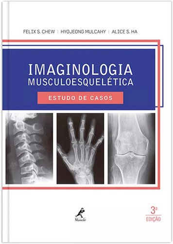 Imaginologia musculoesquelética: Estudo de casos, de Chew, Felix S.. Editora Manole LTDA, capa dura em português, 2016