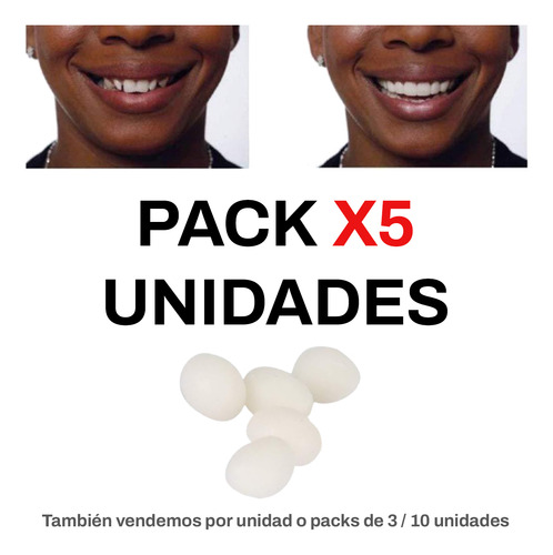 Dientes Flexibles Superiores + Jeringa Blanqueadora Efectiva