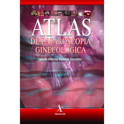 Atlas De Laparoscopia Ginecologica - Pedroza Gonzalez