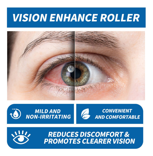 Gel De Olhos R Para Olhos Secos | Pomada De Alívio De Pálpeb