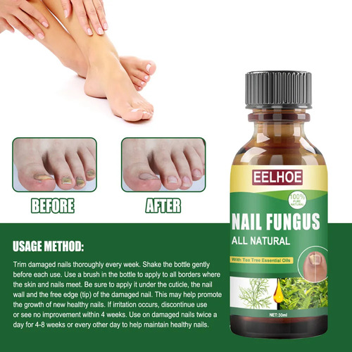Esmalte De Uñas 3toe: Solución Para El Cuidado De Hongos-