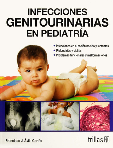 Infecciones Genitourinarias En Pediatría Trillas