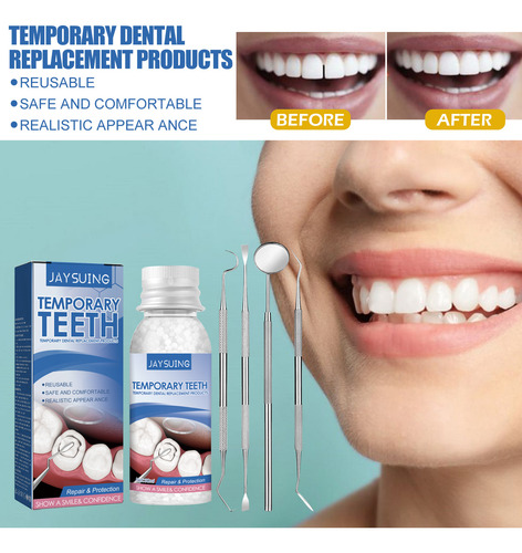 Adhesivo Para Empastes Dentales Kit De Reparación Temporal