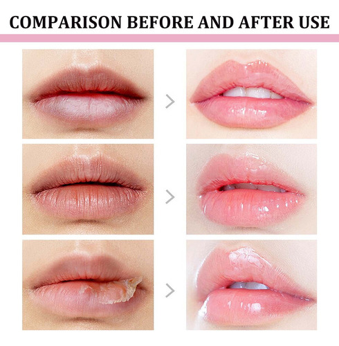 Crema Labial Para Herpes Y Queilitis: Nutre Y Embellece Los