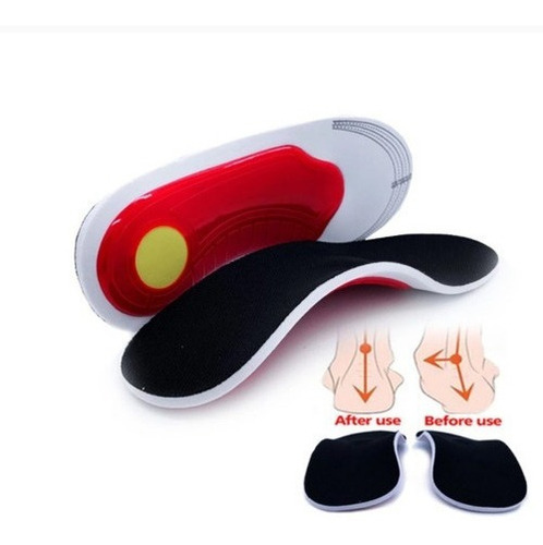 Imagen 2 de 10 de Plantillas Ortopedicas Ajustables Para Fascitis - Unisex