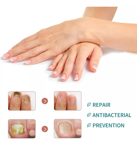Parche Reparador Uñas Lr 32 Patches