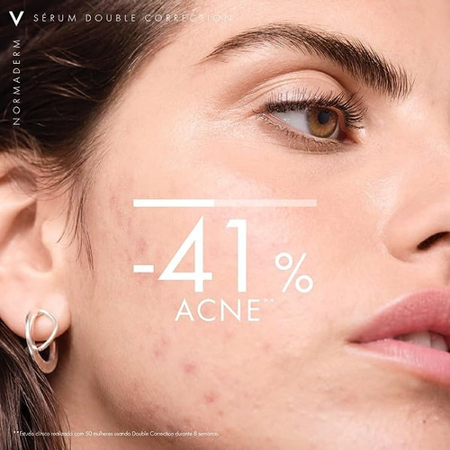 Sérum facial antiacné de doble corrección Normaderm, 50 g, Vichy, día y noche, piel grasa