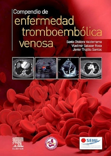 Compendio De Enfermedad Tromboembólica Venosa - Otálora
