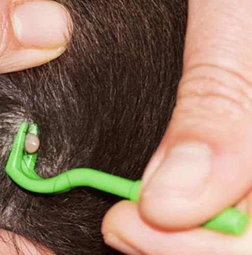 Tecnoservan Pinza Para Quitar Garrapatas, Cuidado De