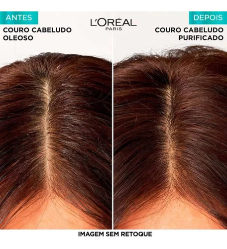 Kit Elseve Pure Hialurônico Shampoo + Condicionador 200ml