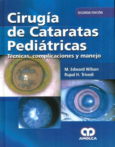 Libro Cirugía De Cataratas Pediátricas. Técnicas, Complicaci