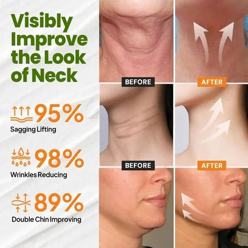Ah-8 Neck Firming Cream, Creme Reafirmante Para O Pescoço E
