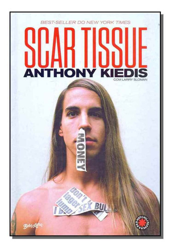 Scar Tissue