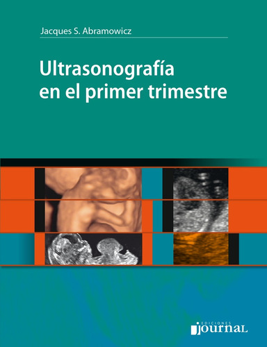 Abramowicz Ultrasonografía En El Primer Trimestre 1ed/2019