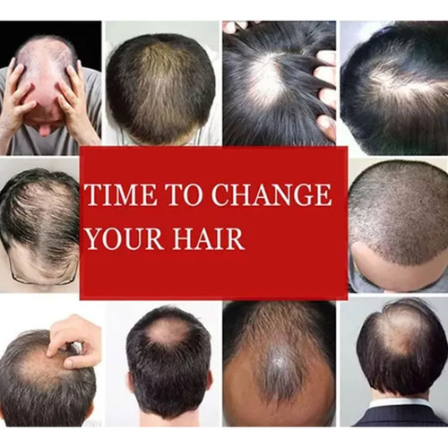 Simulación Peluca De Cabello Negro Para Hombres Negros A