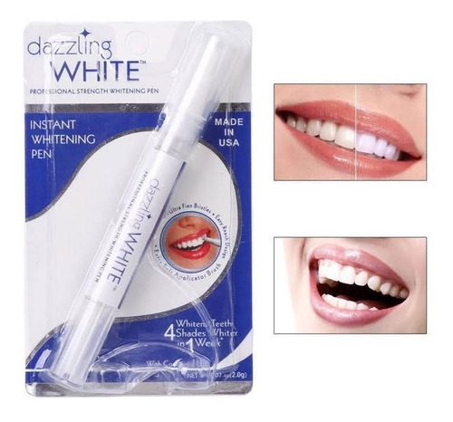 Lápiz Blanqueador Dental Instantáneo Dientes Peróxido Gel